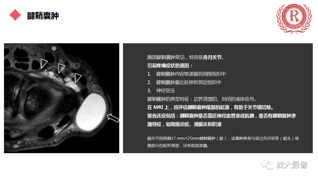 影像PPT - 【PPT】腕关节MRI解剖与临床-75