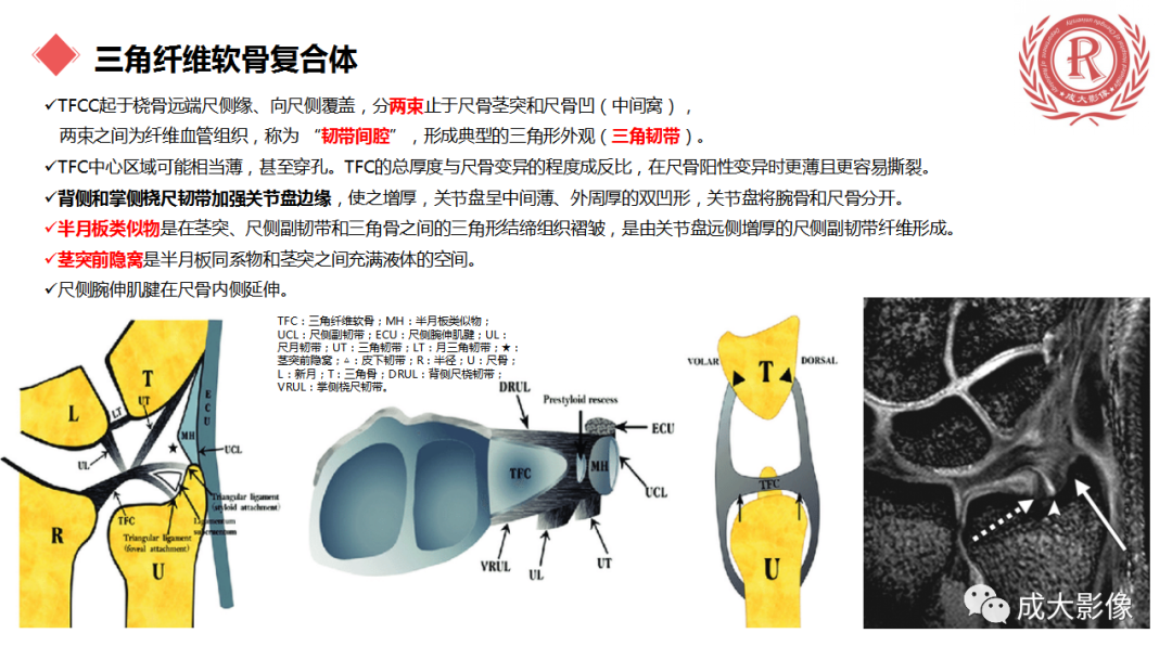 影像PPT - 【PPT】腕关节MRI解剖与临床-1