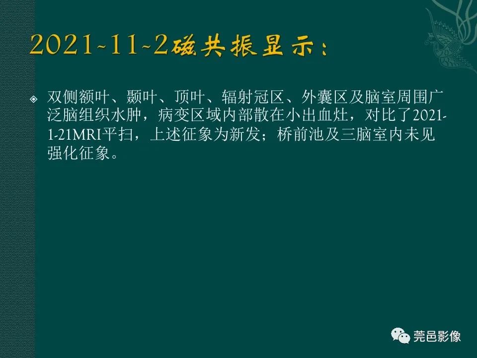 影像PPT - 【PPT】CAR-T治疗难治复发急性B淋巴细胞白血病相关性脑病（CRES）的影像学表现初步分析（1例）-13