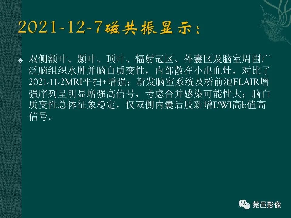 影像PPT - 【PPT】CAR-T治疗难治复发急性B淋巴细胞白血病相关性脑病（CRES）的影像学表现初步分析（1例）-17