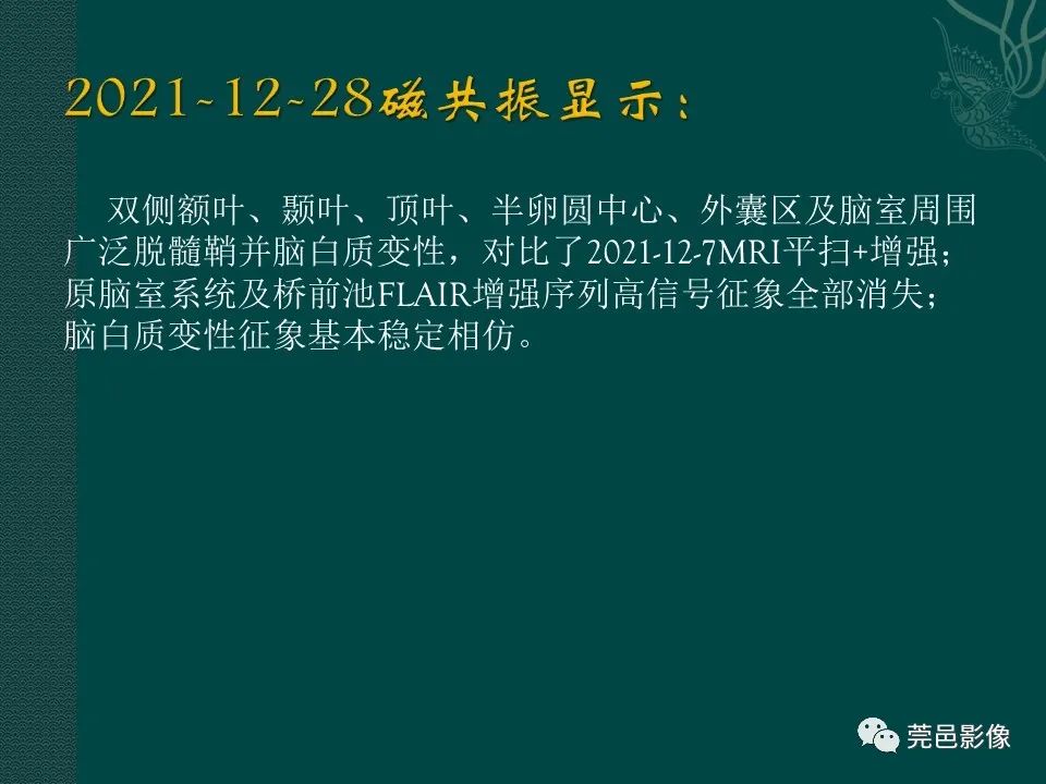 影像PPT - 【PPT】CAR-T治疗难治复发急性B淋巴细胞白血病相关性脑病（CRES）的影像学表现初步分析（1例）-20