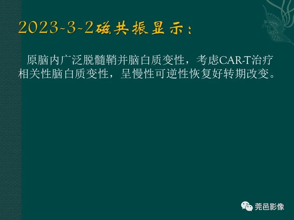 影像PPT - 【PPT】CAR-T治疗难治复发急性B淋巴细胞白血病相关性脑病（CRES）的影像学表现初步分析（1例）-25