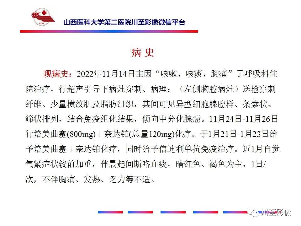 影像PPT - 【PPT】肺癌-3 影像PPT - 【PPT】肺癌-3