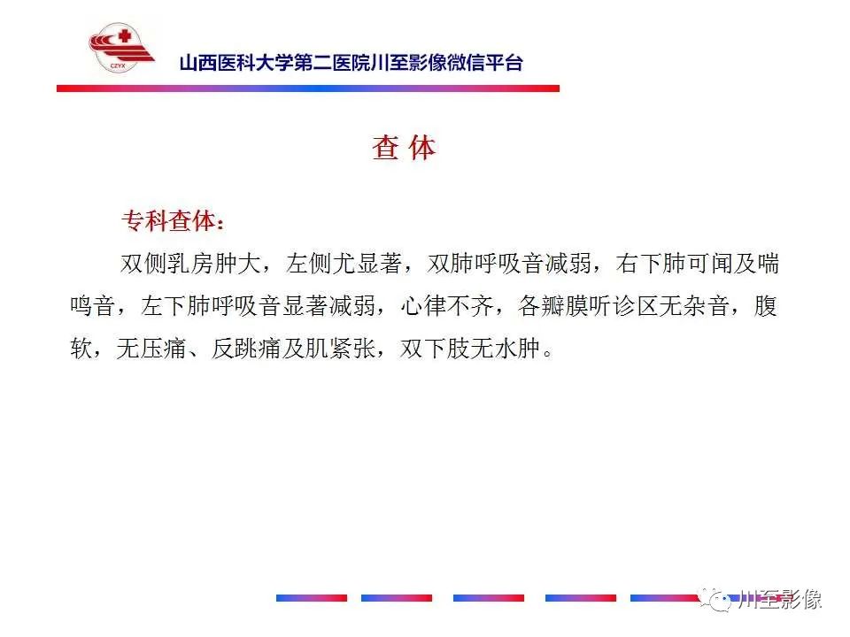 影像PPT - 【PPT】肺癌-4 影像PPT - 【PPT】肺癌-4