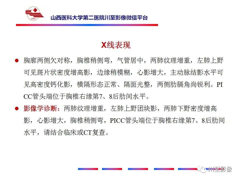 影像PPT - 【PPT】肺癌-6 影像PPT - 【PPT】肺癌-6