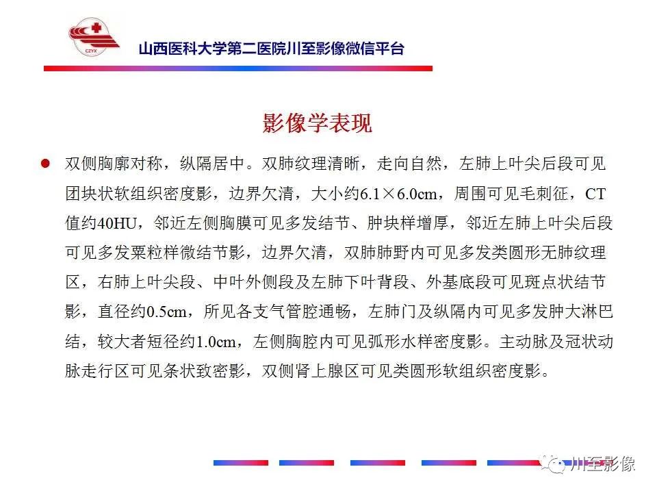 影像PPT - 【PPT】肺癌-9 影像PPT - 【PPT】肺癌-9