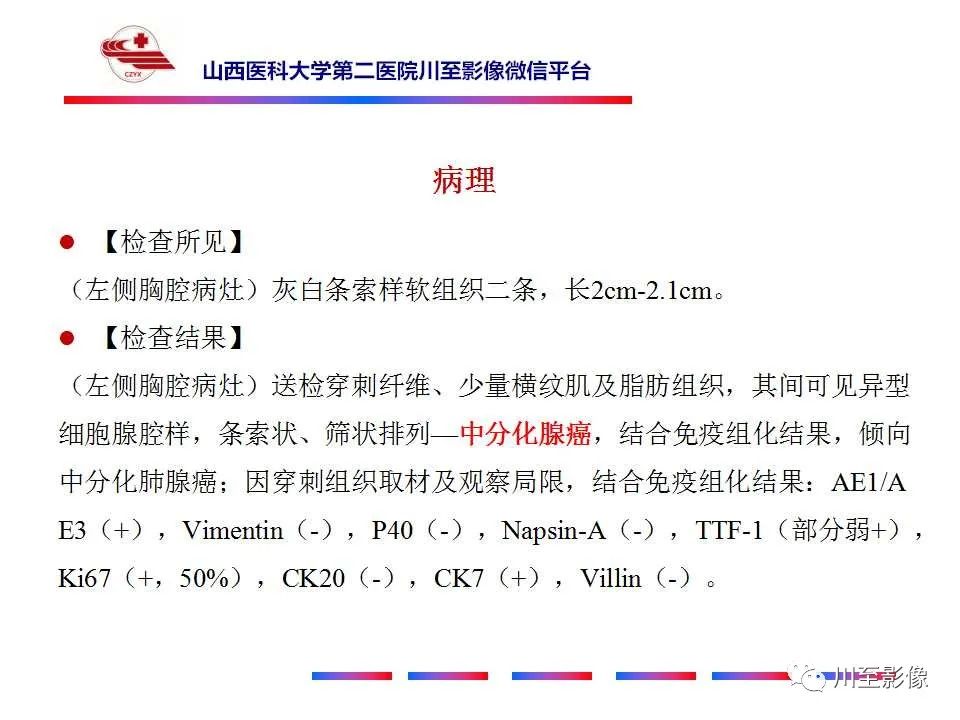 影像PPT - 【PPT】肺癌-12 影像PPT - 【PPT】肺癌-12