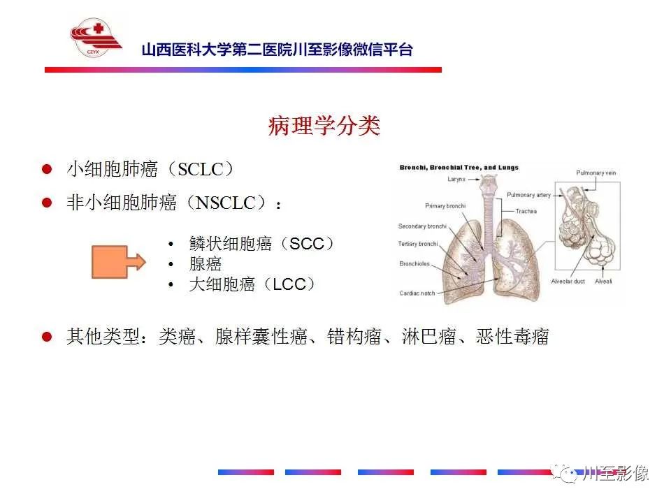 影像PPT - 【PPT】肺癌-15 影像PPT - 【PPT】肺癌-15