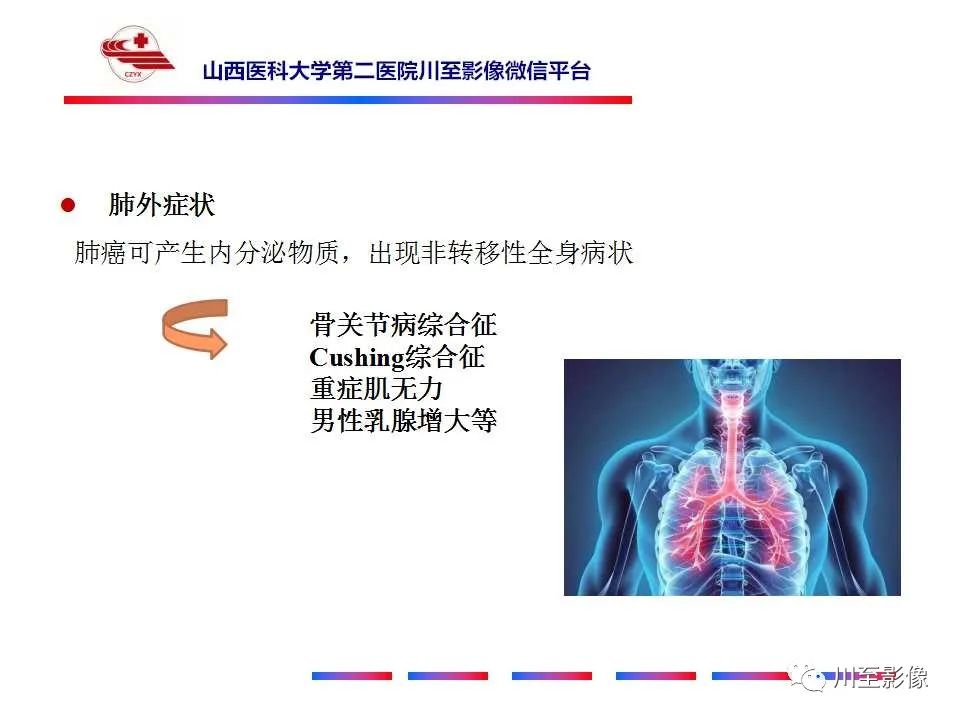 影像PPT - 【PPT】肺癌-19 影像PPT - 【PPT】肺癌-19