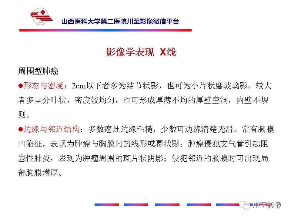 影像PPT - 【PPT】肺癌-26 影像PPT - 【PPT】肺癌-26
