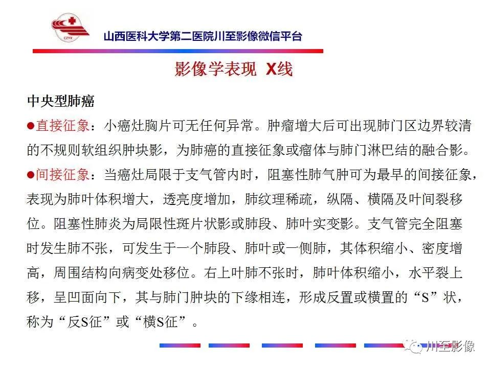 影像PPT - 【PPT】肺癌-25 影像PPT - 【PPT】肺癌-25