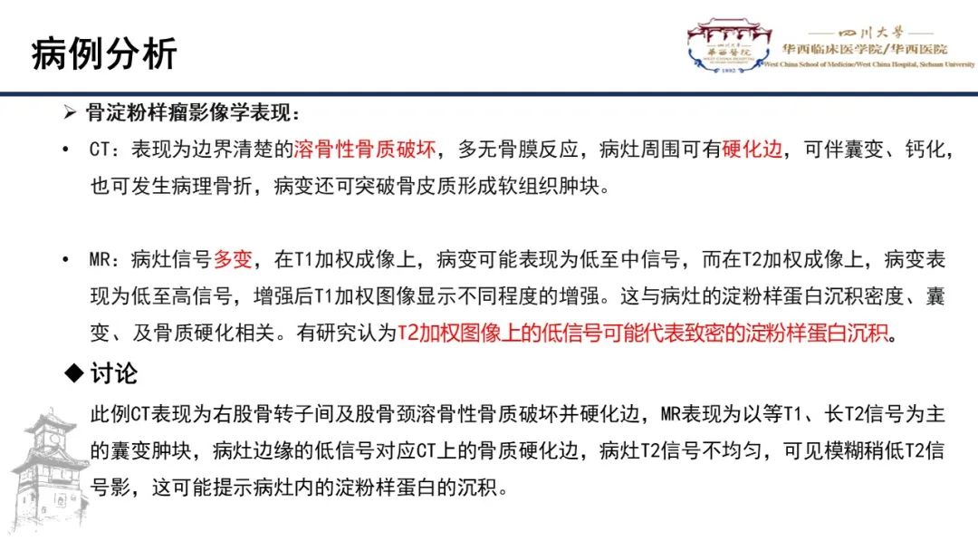 影像PPT - 【病例】股骨淀粉样瘤1例影像诊断及鉴别-12