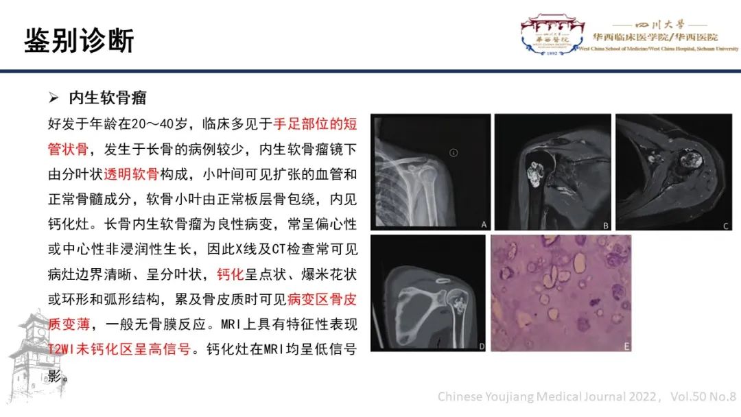 影像PPT - 【病例】股骨淀粉样瘤1例影像诊断及鉴别-13