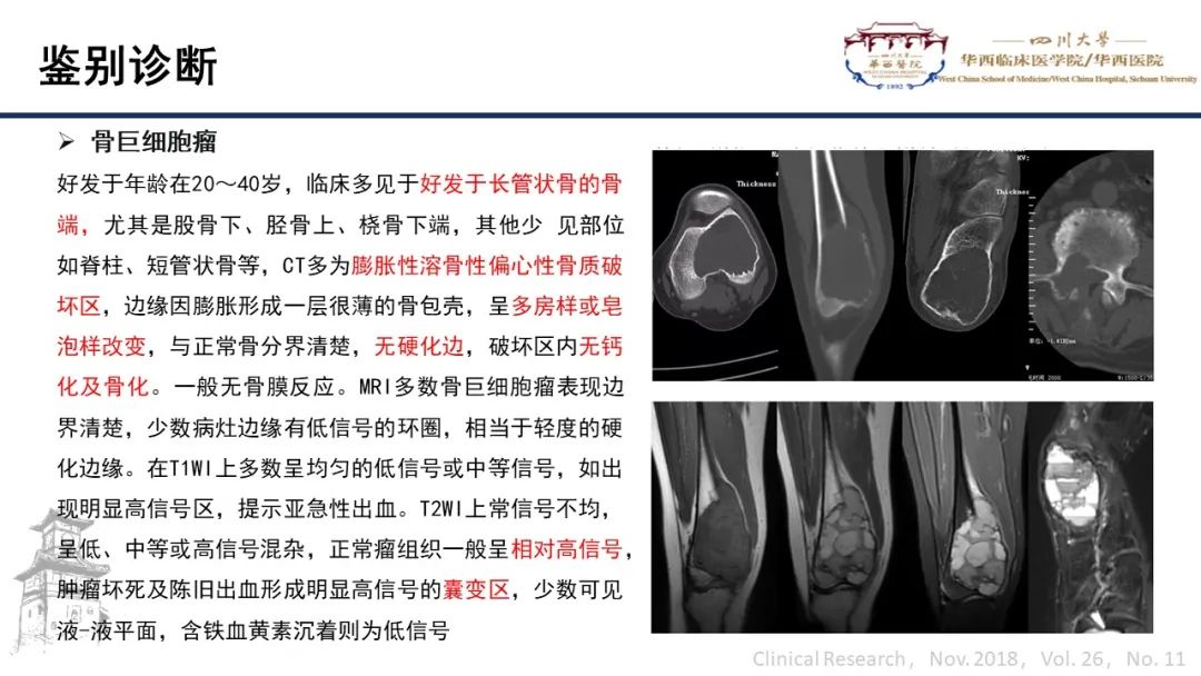 影像PPT - 【病例】股骨淀粉样瘤1例影像诊断及鉴别-14