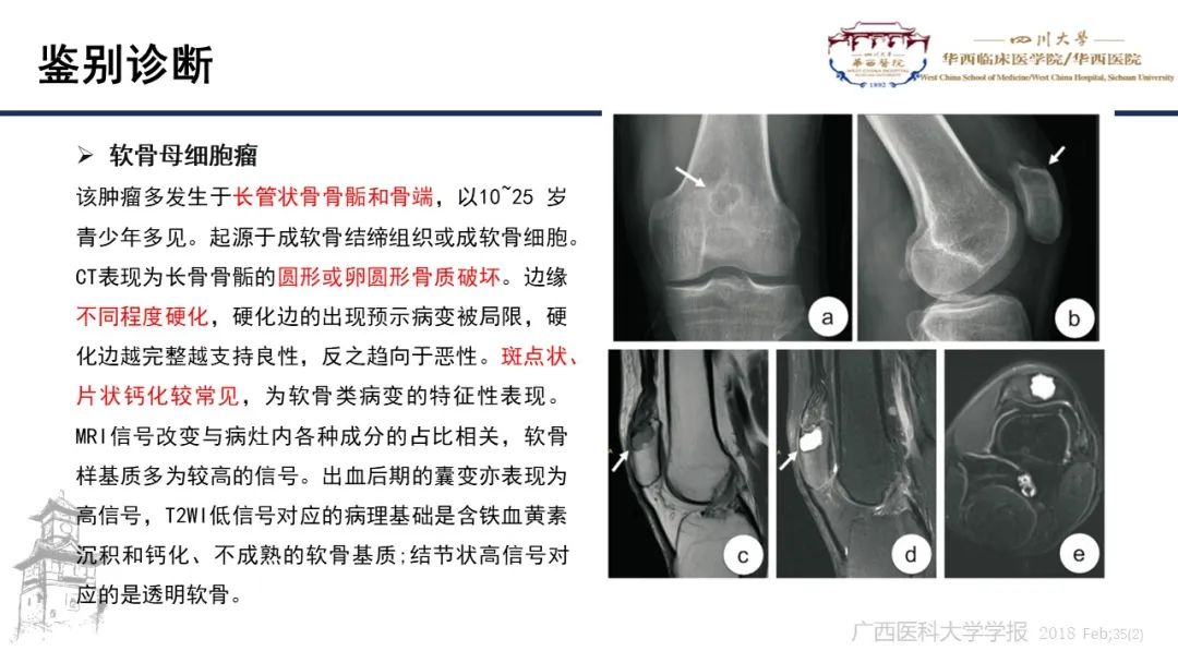 影像PPT - 【病例】股骨淀粉样瘤1例影像诊断及鉴别-15