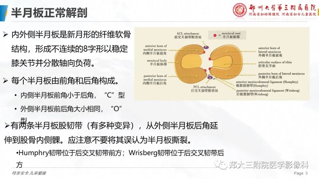 影像PPT - 【PPT】膝关节半月板病变的影像表现-3