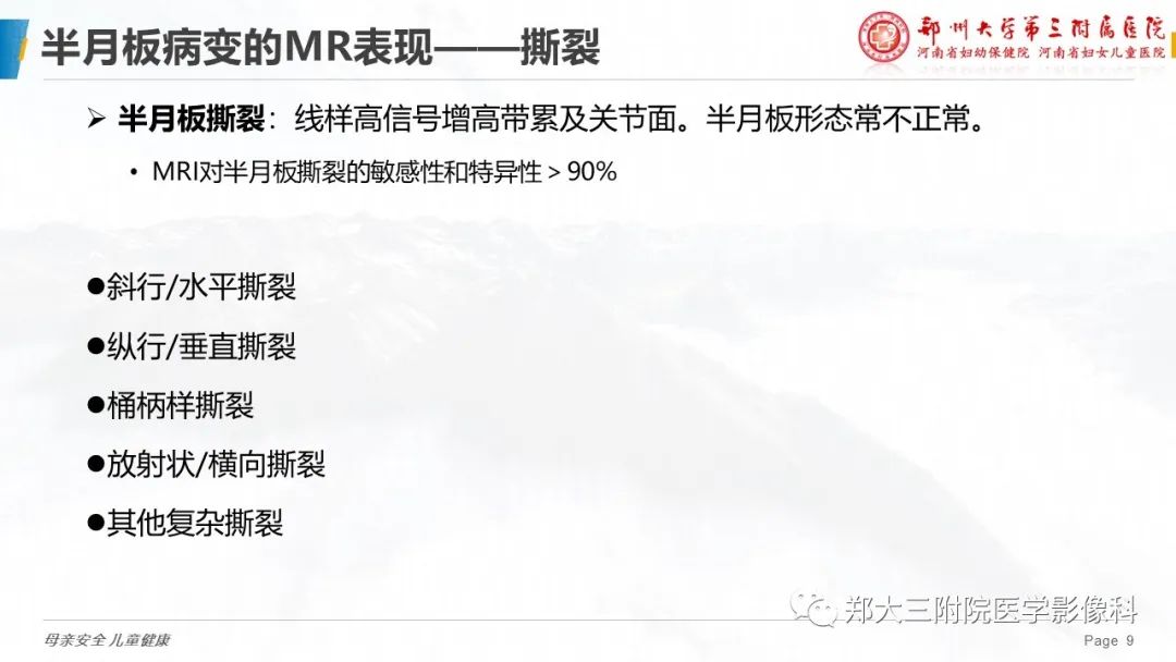 影像PPT - 【PPT】膝关节半月板病变的影像表现-9