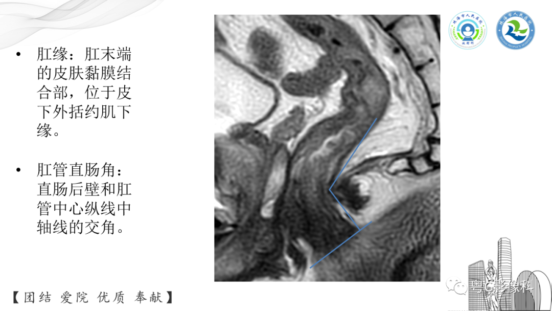 影像PPT - 【PPT】直肠癌—MR DISTANCE分期解读-6 影像PPT - 【PPT】直肠癌—MR DISTANCE分期解读-6