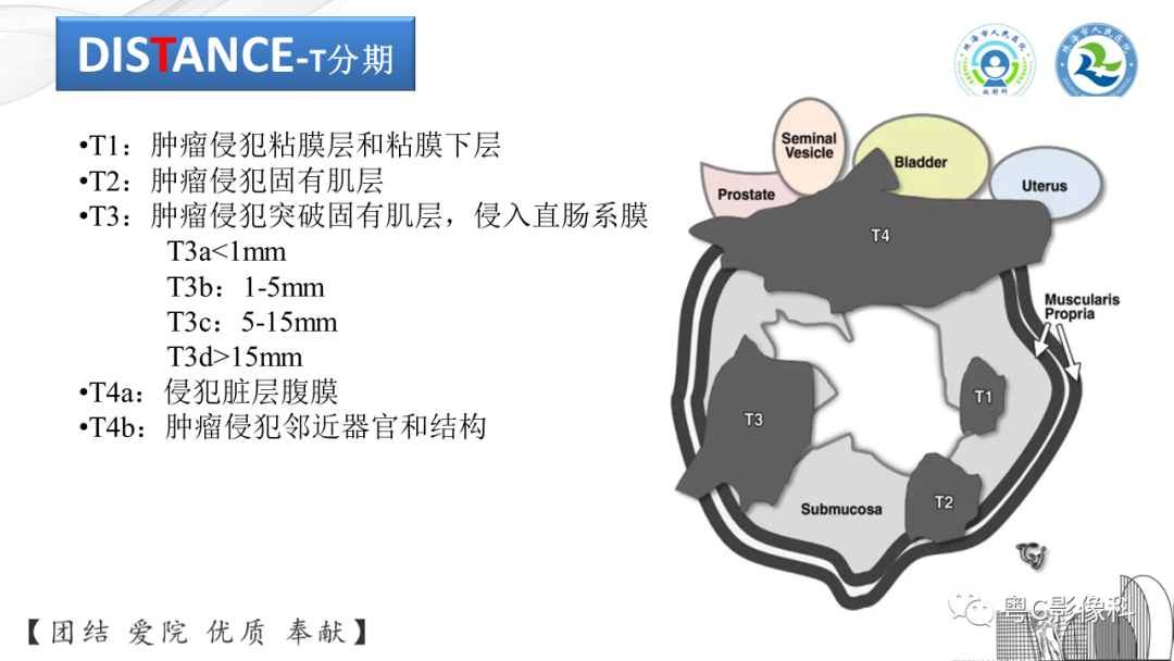 影像PPT - 【PPT】直肠癌—MR DISTANCE分期解读-8 影像PPT - 【PPT】直肠癌—MR DISTANCE分期解读-8