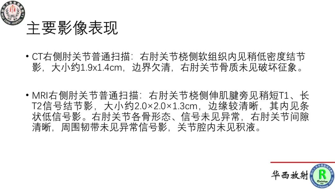 影像PPT - 【病例】肘关节滑膜肉瘤1例CT及MR影像-9