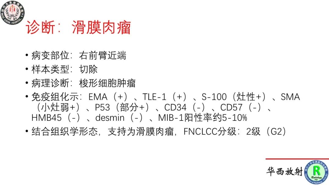 影像PPT - 【病例】肘关节滑膜肉瘤1例CT及MR影像-10