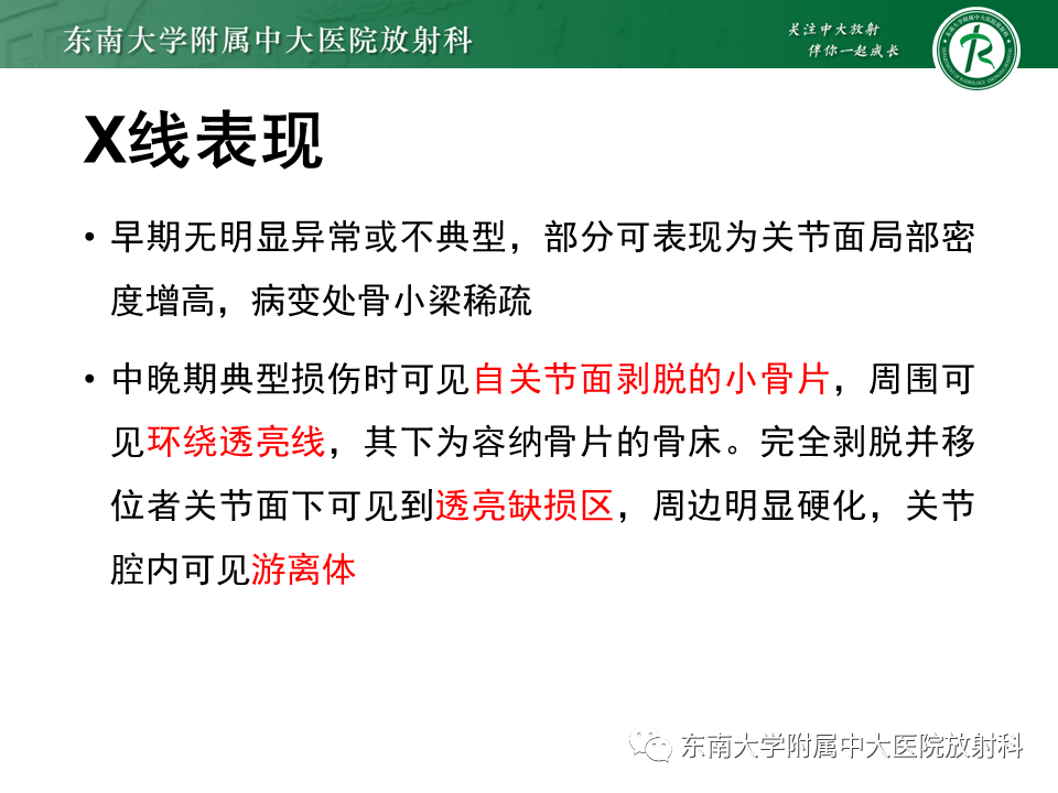 影像PPT - 【PPT】剥脱性骨软骨病-10