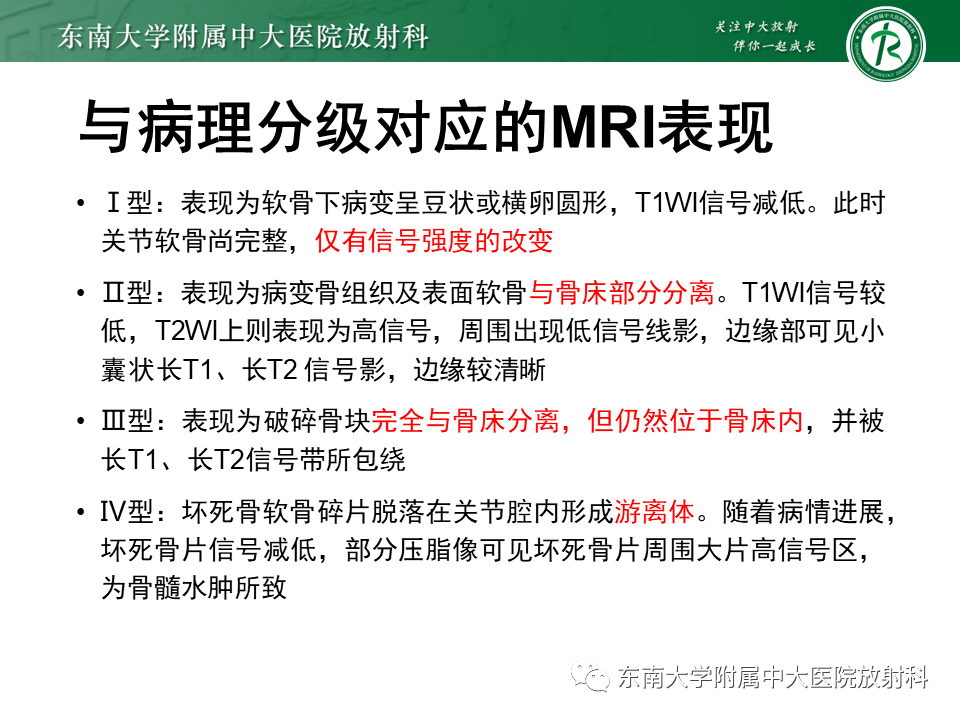 影像PPT - 【PPT】剥脱性骨软骨病-12