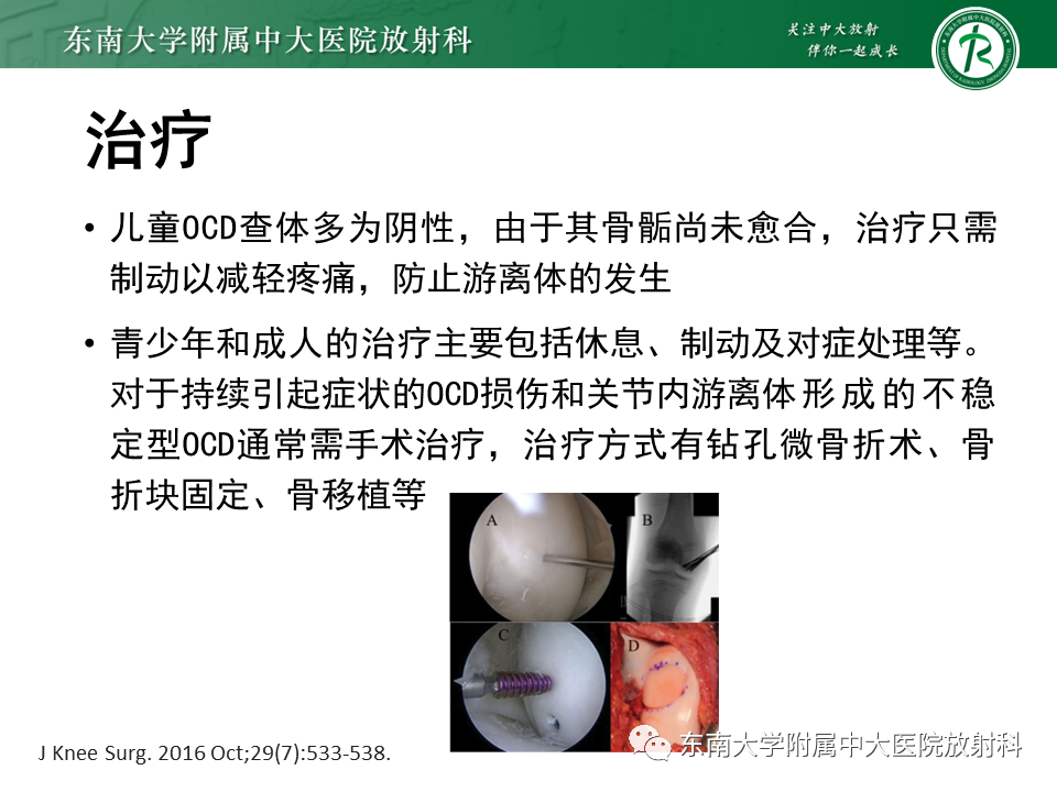 影像PPT - 【PPT】剥脱性骨软骨病-15