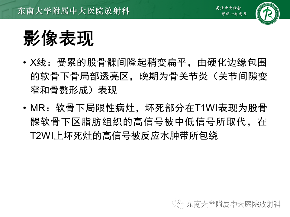 影像PPT - 【PPT】剥脱性骨软骨病-21