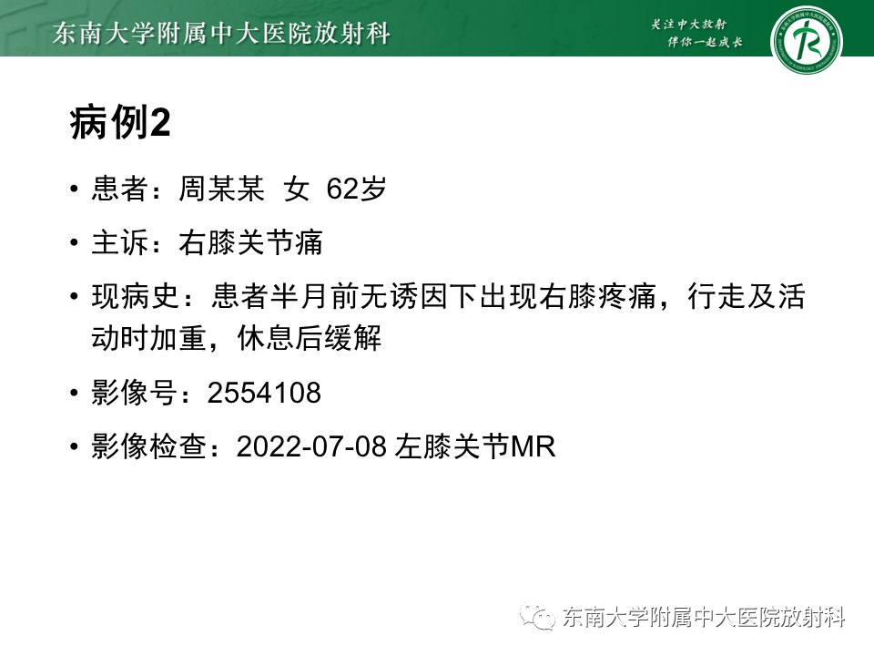 影像PPT - 【PPT】剥脱性骨软骨病-23
