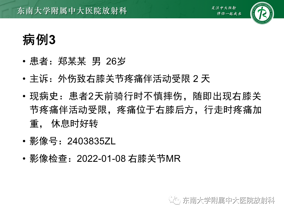 影像PPT - 【PPT】剥脱性骨软骨病-26