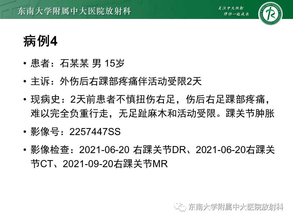 影像PPT - 【PPT】剥脱性骨软骨病-29