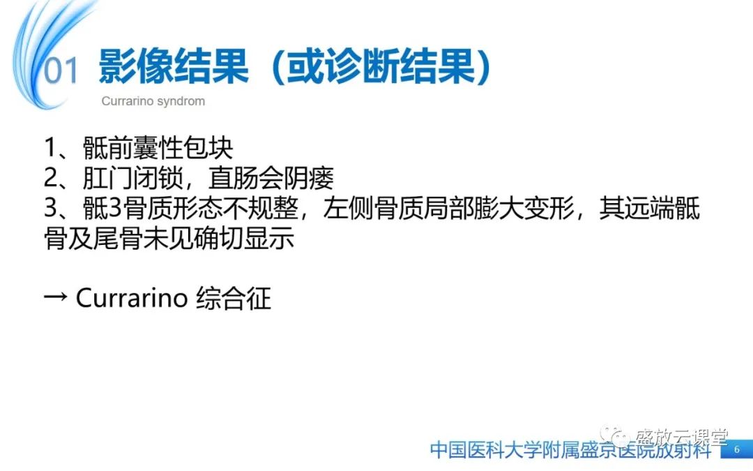 影像PPT - 【病例】Currarino综合征1例CT及MR影像-6