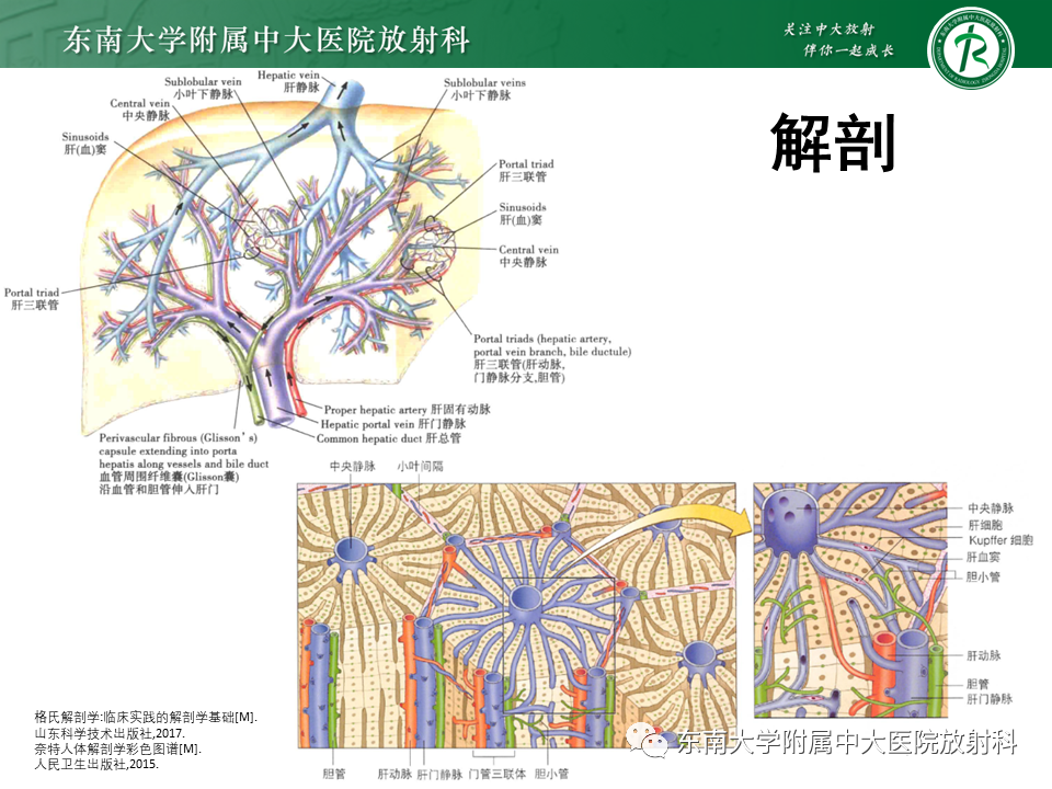 影像PPT - 【PPT】肝血管肉瘤-5
