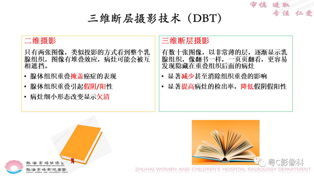 影像PPT - 【PPT】DBT在乳腺癌筛查与诊断中的应用体会-16