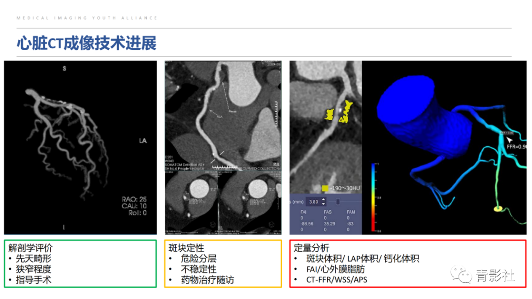 影像PPT - 【PPT】CAD-RADS 2.0报告分级解读-17
