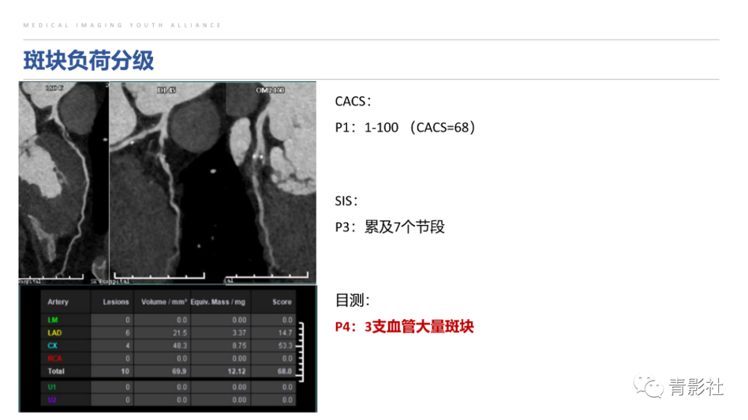 影像PPT - 【PPT】CAD-RADS 2.0报告分级解读-27