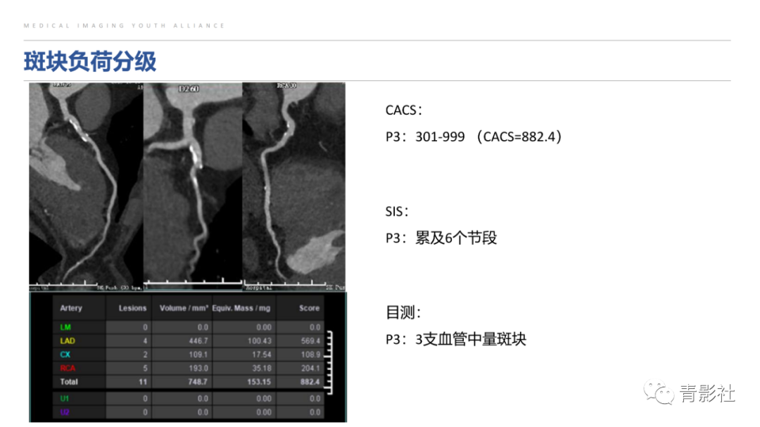 影像PPT - 【PPT】CAD-RADS 2.0报告分级解读-28