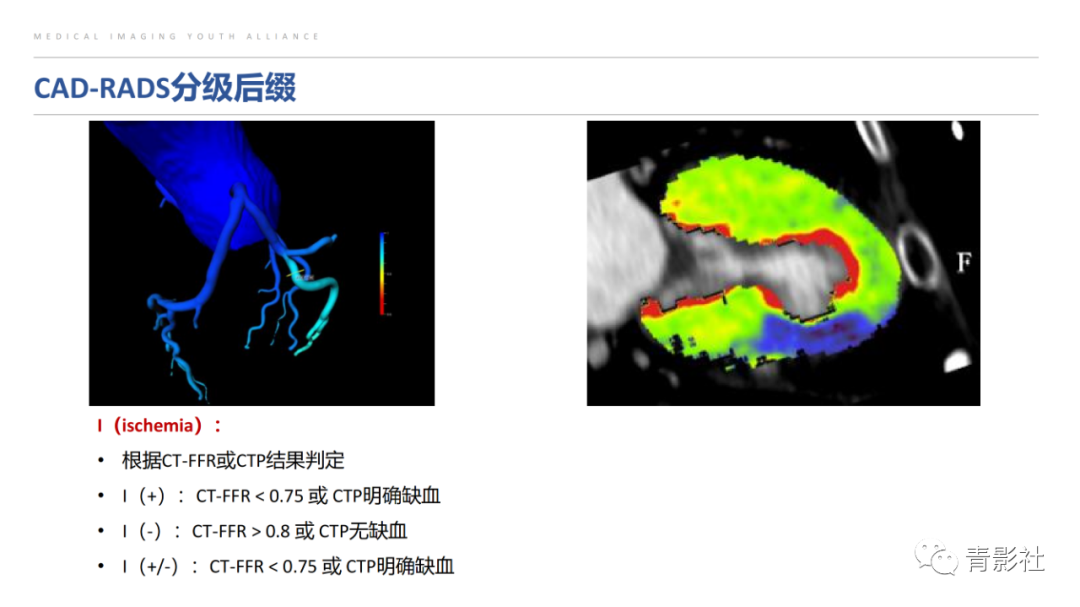 影像PPT - 【PPT】CAD-RADS 2.0报告分级解读-2