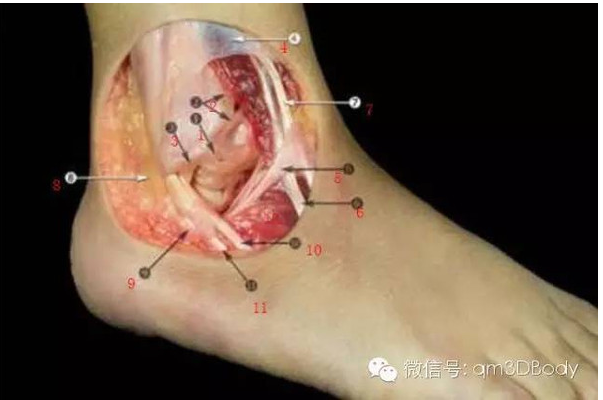 影像PPT - 踝关节韧带大体解剖及断层解剖高清图解-7 影像PPT - 踝关节韧带大体解剖及断层解剖高清图解-7