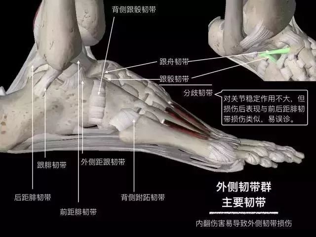 影像PPT - 踝关节韧带大体解剖及断层解剖高清图解-11 影像PPT - 踝关节韧带大体解剖及断层解剖高清图解-11