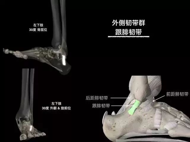 影像PPT - 踝关节韧带大体解剖及断层解剖高清图解-13 影像PPT - 踝关节韧带大体解剖及断层解剖高清图解-13