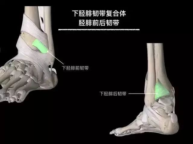 影像PPT - 踝关节韧带大体解剖及断层解剖高清图解-19 影像PPT - 踝关节韧带大体解剖及断层解剖高清图解-19
