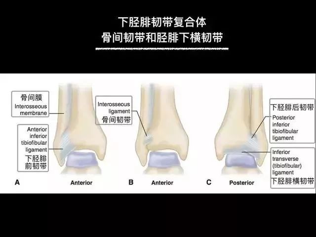影像PPT - 踝关节韧带大体解剖及断层解剖高清图解-20 影像PPT - 踝关节韧带大体解剖及断层解剖高清图解-20