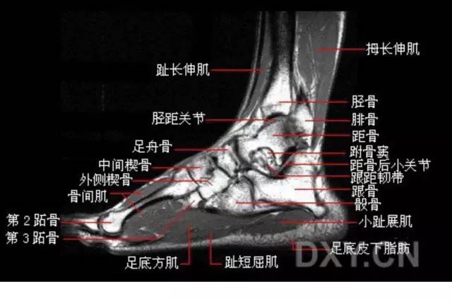 影像PPT - 踝关节韧带大体解剖及断层解剖高清图解-40 影像PPT - 踝关节韧带大体解剖及断层解剖高清图解-40