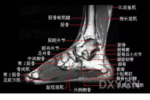 影像PPT - 踝关节韧带大体解剖及断层解剖高清图解-41 影像PPT - 踝关节韧带大体解剖及断层解剖高清图解-41