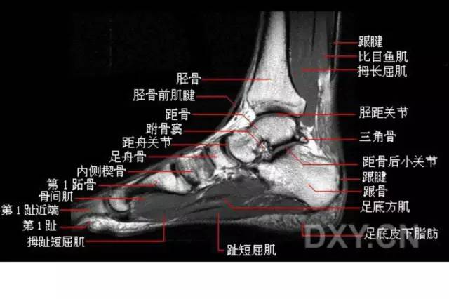 影像PPT - 踝关节韧带大体解剖及断层解剖高清图解-42 影像PPT - 踝关节韧带大体解剖及断层解剖高清图解-42