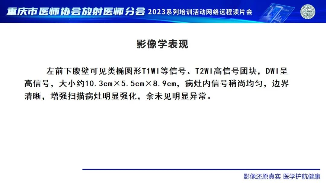 影像PPT - 【病例】腹壁隆突性皮肤纤维肉瘤1例MR影像-15