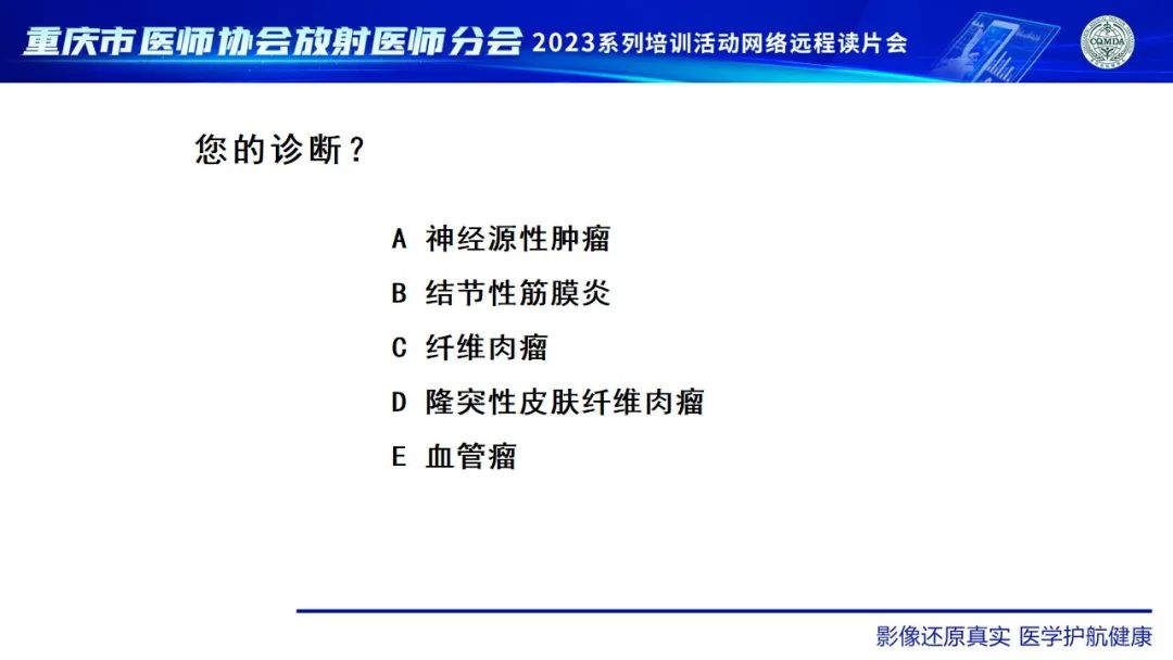 影像PPT - 【病例】腹壁隆突性皮肤纤维肉瘤1例MR影像-17
