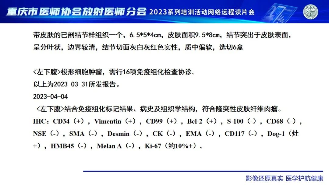 影像PPT - 【病例】腹壁隆突性皮肤纤维肉瘤1例MR影像-19
